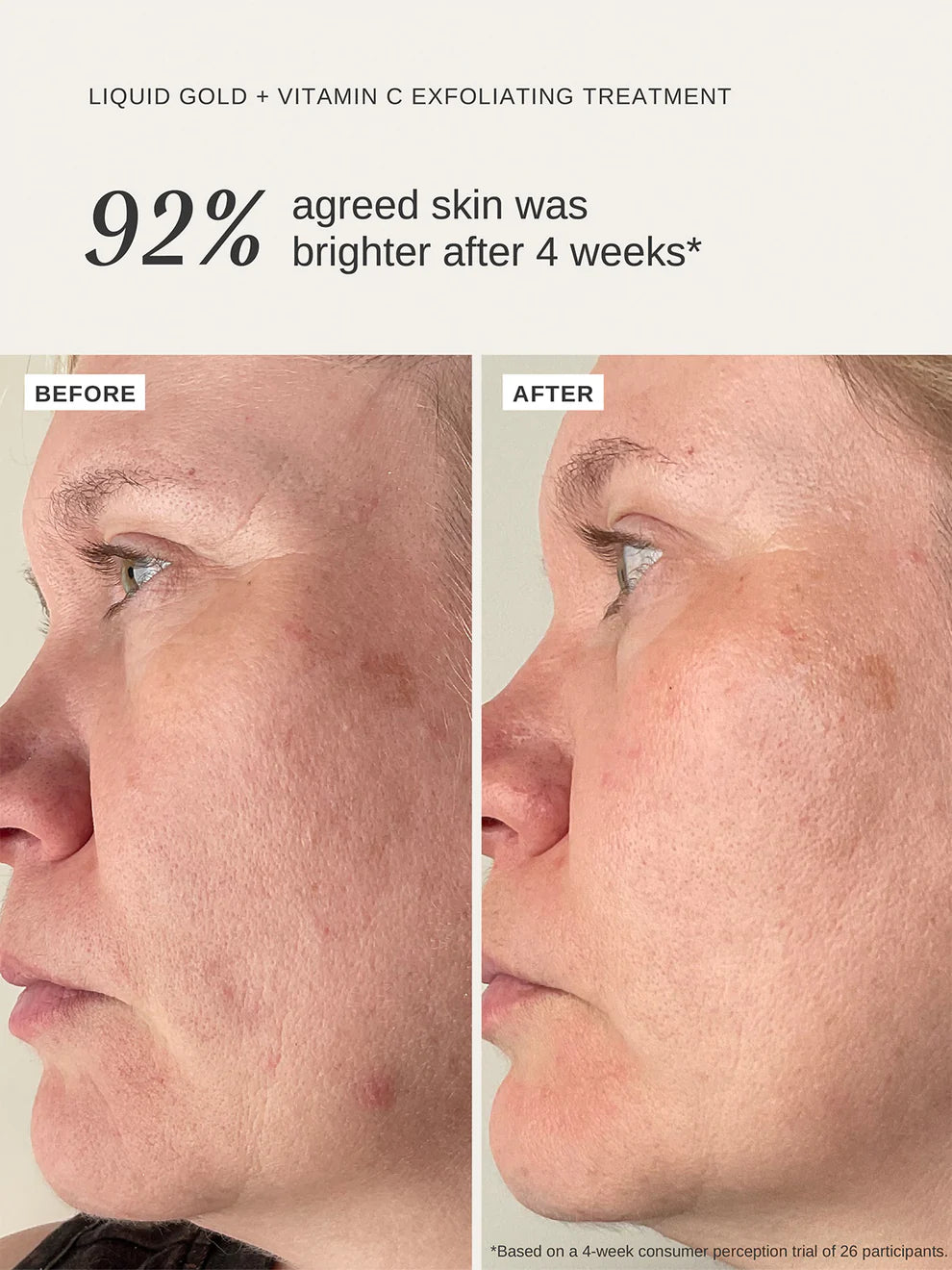 Liquid Gold + Vitamin C Trial Kit